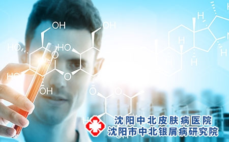 治疗银屑病使用生物制剂后，病情会反复吗