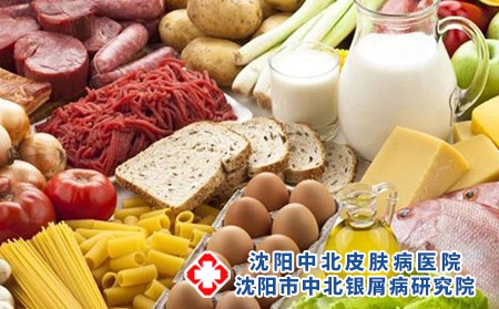 牛皮癣患者能喝咖啡吗?危害有哪些?饮食健康?