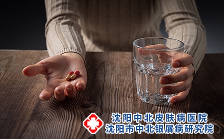 西医如何治疗牛皮癣