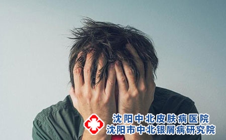 银屑病日常生活中的禁忌有哪些?