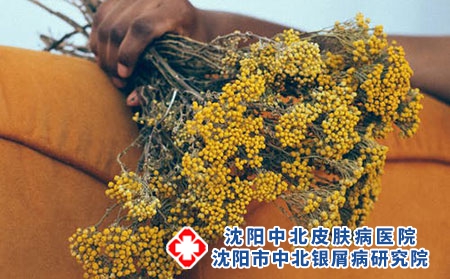 沈阳银屑病医院哪家好：沈阳中北银屑病研究院