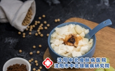 牛皮癣能吃豆制品吗