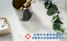 用来治疗牛皮癣的土方法？