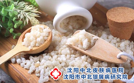 沈阳银屑病皮肤研究院：牛皮癣的类型有哪些呢?