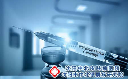 沈阳中北医院哪个医生治疗牛皮癣好?