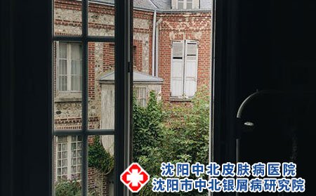 牛皮癣患者的日常饮食应该注意什么?