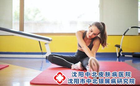 女性如何预防牛皮癣?日常护理需要注意什么?