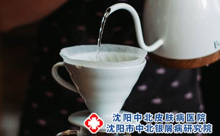 治疗牛皮癣有什么注意要点吗?