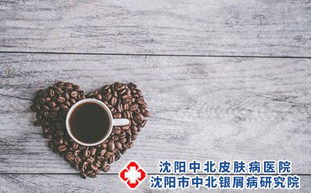 银屑病治疗的误区有哪些?